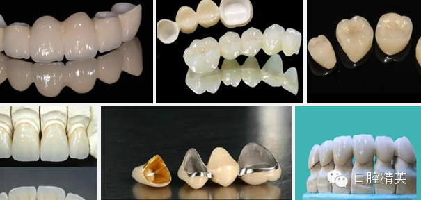 口腔最新材料探索,小巷中的隐秘宝藏开启口腔护理之旅